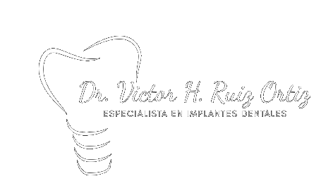 Implantes Dentales Zacatecas Sucursal Jerez